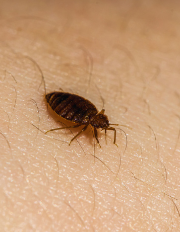 Bed bug on human skin Bed bug on human skin